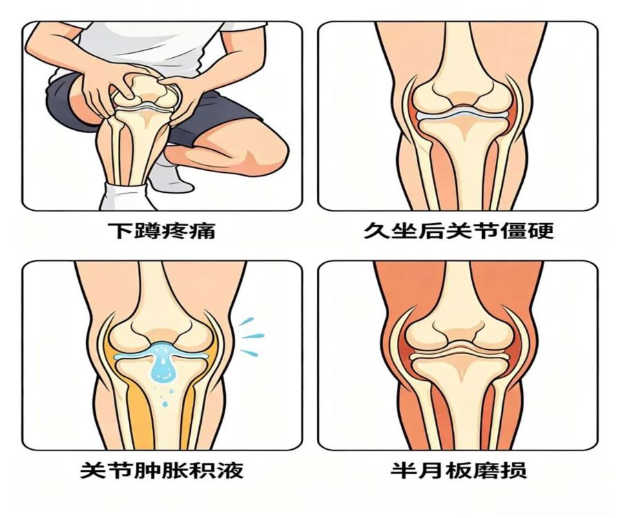5·27全国爱膝日｜科学护膝保膝，从日常的细节做起