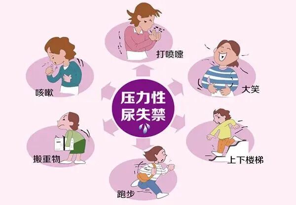 健康科普 | 漏尿不是小事：藏在 “笑尿了” 背后的盆底隐患