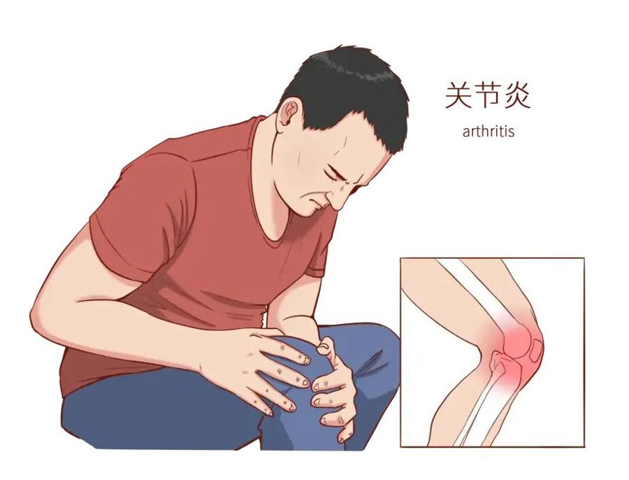 健康科普 | 警惕关节慢性磨损，科学认识骨关节炎